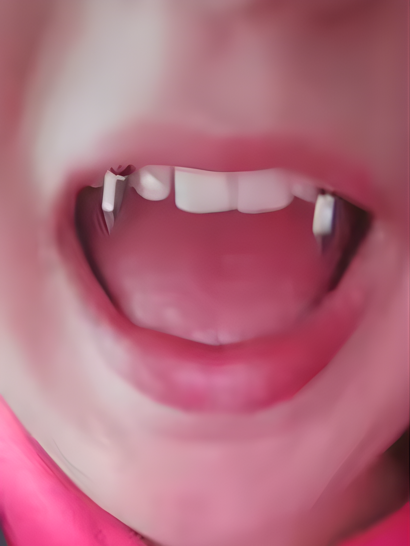 Vampire Gothic Septum
